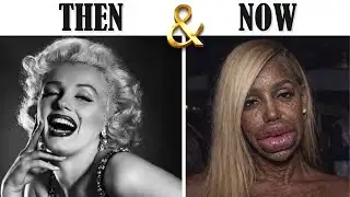 10 Hollywood Stars Obsessed With Perfect Faces | Then and Now 2026