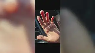 2 Warren Central students suffer second-degree burns after dance practice punishment