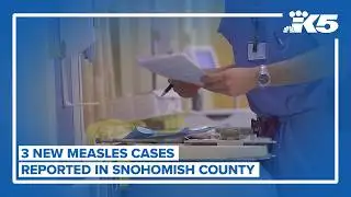3 new measles cases reported in Snohomish County