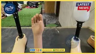 जर्मन तकनीक से कृत्रिम अंग माप एवं मूल्यांकन, 35 दिव्यांगजन चिन्हित @thebluecitynews 