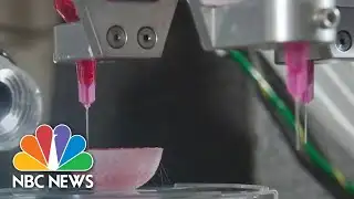 3D printing: The future of organ transplants