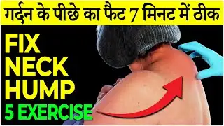 5 Neck Hump Exercises Hindi 2023 | Fix Neck Hump at Home