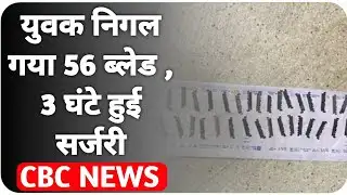 युवक निगल गया 56 BLADE , 3 घंटे हुई Surgery || Jalore Viral News ||