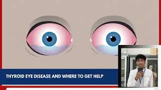 A news article about health by Kent || Thyroid Eye Disease (TED)