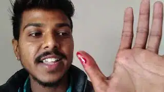 छोटी सी गलती… उंगली से बहने लगा खून 😱 | A small mistake… blood started flowing from the finger