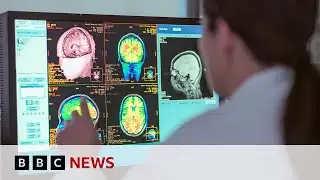 Adolescence lasts into 30s, new study shows | BBC News