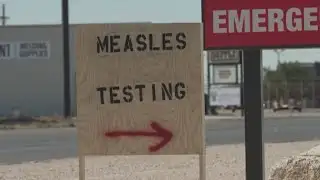 ADPH announces first Measles case since 2002