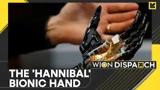 AI Bionic Limb, Ready To Be Used In Just One Week | New Era For Prosthetics | WION