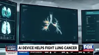 AI-powered device helps doctors detect lung cancer earlier