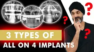 All on 4 Just Got More Complicated: Here