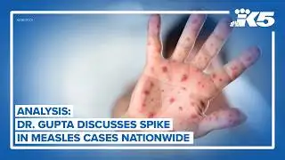 Analysis: Dr. Gupta discusses the spike in measles cases nationwide