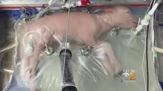 Artificial Womb Could Give Premature Babies Extra Time To Develop