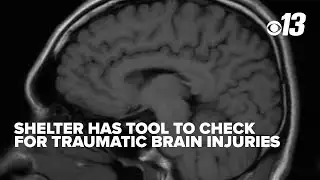 Audrain County shelter uses cutting-edge tool to screen for traumatic brain injuries