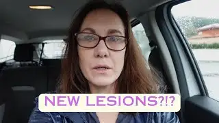 Bad News About My MS... | Carnivore Diet & Multiple Sclerosis