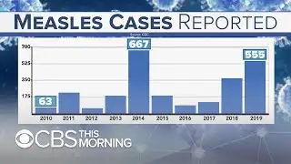 Behind the latest spike in measles cases