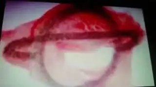 Blood Over Intent Saves the Universe