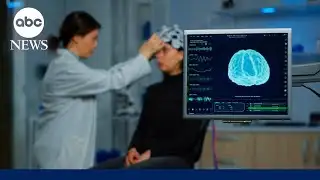 Brain aging study finds adolescence may continue until age 32