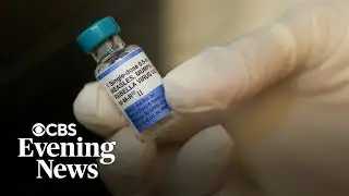 Breaking down new CDC recommendation on MMRV vaccine
