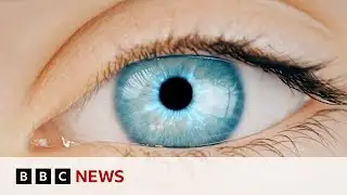 Can AI-powered eye scans help identify diseases? | BBC News