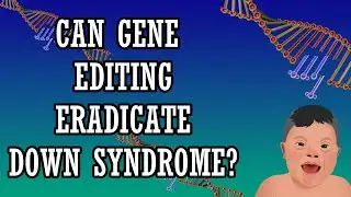 Can Down Syndrome Be Eliminated Using CRISPR Gene Editing 