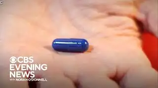 Can psychedelic therapy help treat PTSD?