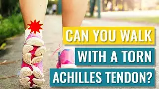 Can You Walk on a Torn Achilles Tendon? Partial / Full Ruptures