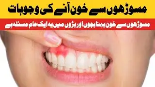 Causes of bleeding gums | Daily Jang