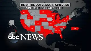 CDC issues new global alert on hepatitis cases in children | ABCNL