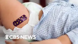 CDC panel changes measles, mumps, rubella, varicella vaccine recommendation