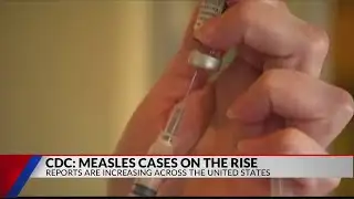CDC releases measles numbers