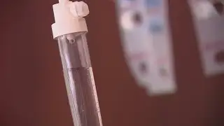 Chemotherapy offers clues for potential HIV cure