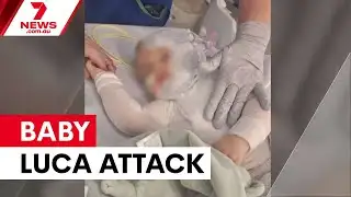 Chinese authorities to help investigate baby coffee attack | 7NEWS