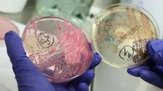 Chinese Researcher Charged For Smuggling E. Coli