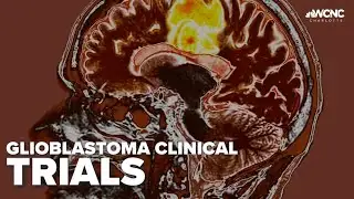 Cleveland Clinc trial testing treatment for glioblastoma
