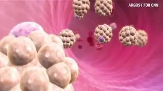 CNN Explains: Cholesterol