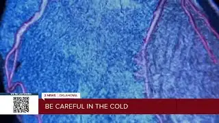 Cold weather makes heart work harder