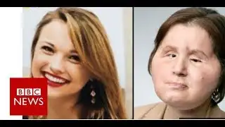 Coping with our daughter