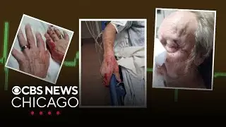 Couple beaten in road rage attack in Oak Lawn