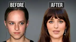 Dakota Johnson: Way More Surgery Than I Expected