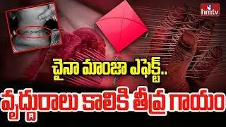 చైనా మాంజా ఎఫెక్ట్.. వృద్దురాలు కాలికి తీవ్ర గాయం | Dangerous China Manja | Sankranti | hmtv