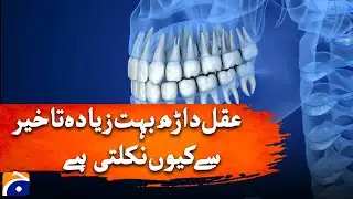 Delayed Wisdom Teeth: What’s the Reason? - Breaking News