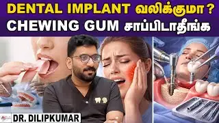 DENTAL IMPLANT செய்வதற்கு முன்னாடி இதெல்லாம் தெரிஞ்சுக்கோங்க | Dr. Dilipkumar | Aadhan Aarogyam