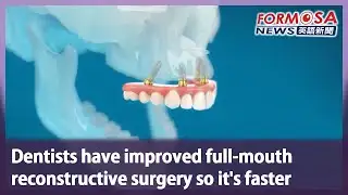 Dentists have improved full-mouth reconstructive surgery so it’s faster｜Taiwan News