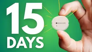 Dexcom G7 15 Day Explained 