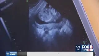 Dr. Griggs - Chemicals May Affect Newborn Brain Development