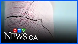 Every seven minutes a Canadian dies from heart disease or stroke: study