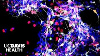 Exploring Stem Cell Treatments for Glaucoma-Related Blindness | UC Davis Health Research