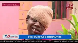 Eye surface growths | NTV Medical Matters