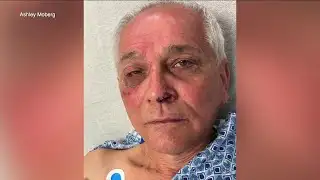 Father, daughter struck by lightning