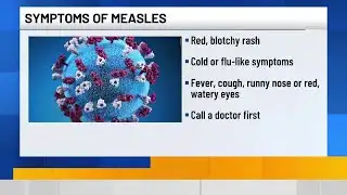 First measles case confirmed in Polk County in nearly 30 years